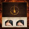 herbleafycom-indulekha-bringha-ayurvedic-hair-oil-hair-fall-control-indulekha-hair-oil